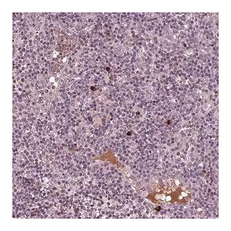 Merck Anti-PTX4 antibody produced in rabbit
