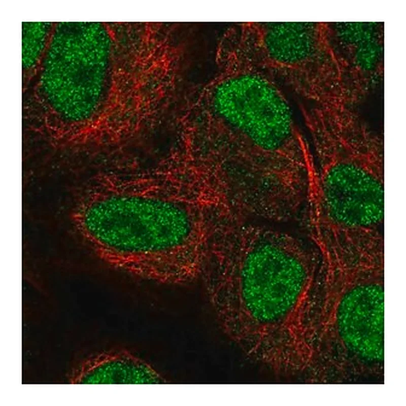 Merck Anti-NEIL2 antibody produced in rabbit