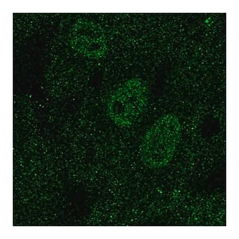 Merck Anti-TAL1 antibody produced in rabbit