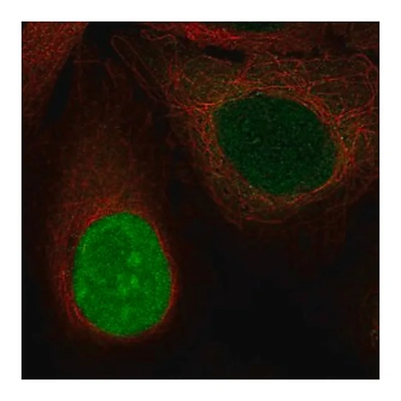 Merck Anti-NUSAP1 antibody produced in rabbit