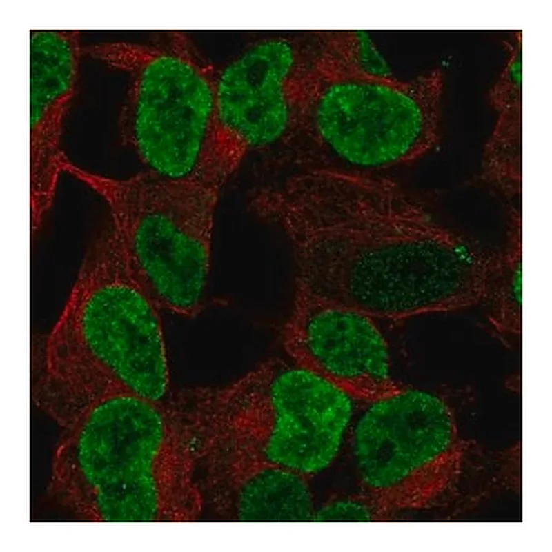 Merck Anti-PHOX2B antibody produced in rabbit