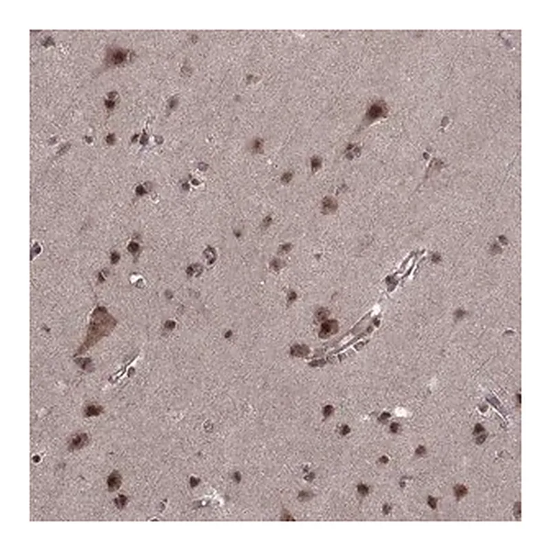 Merck Anti-PTOV1 antibody produced in rabbit