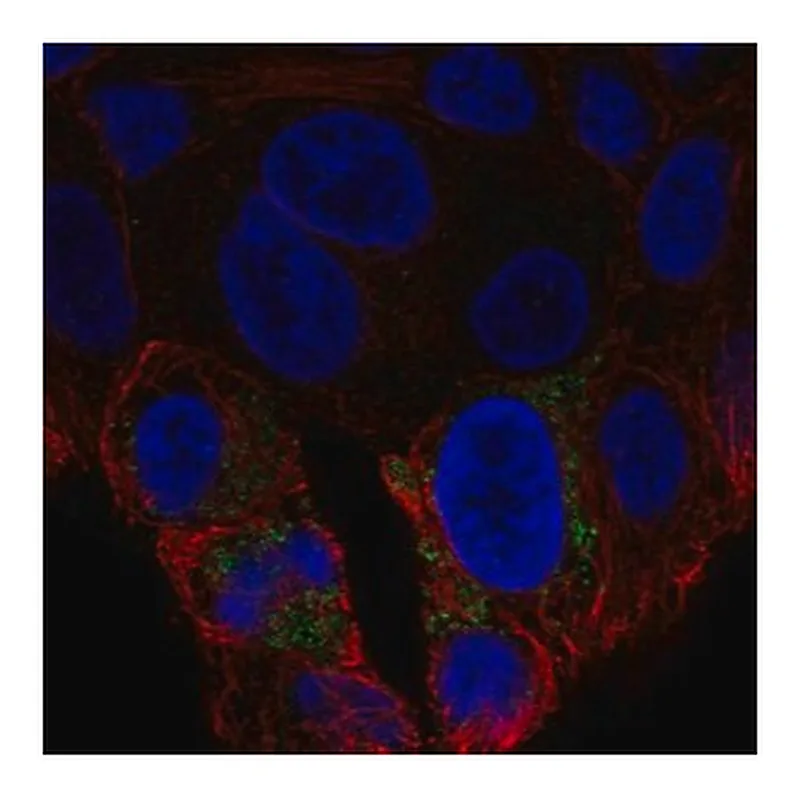 Merck Anti-UCP2 antibody produced in rabbit