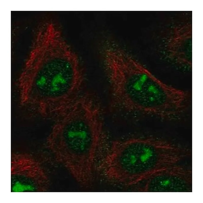 Merck Anti-BAHCC1 antibody produced in rabbit