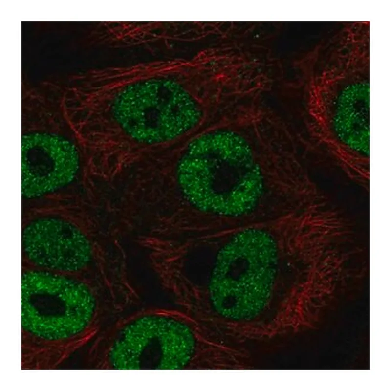 Merck Anti-BNC1 antibody produced in rabbit