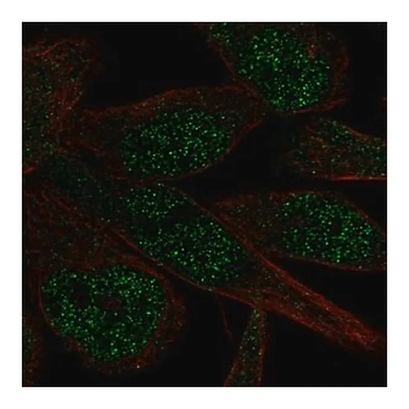 Merck Anti-ZNF273 antibody produced in rabbit