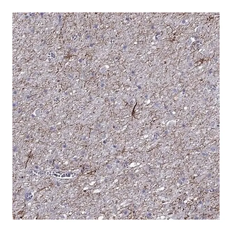 Merck Anti-TMEM155 antibody produced in rabbit
