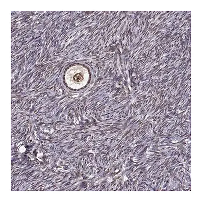 Merck Anti-EZH1 antibody produced in rabbit
