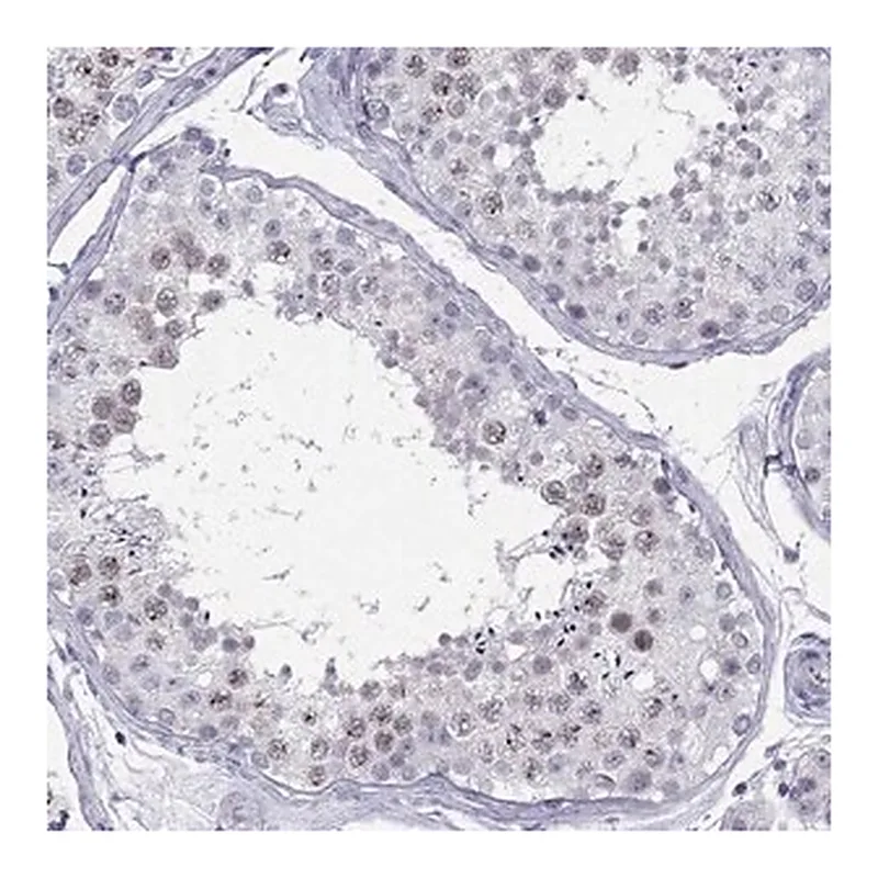Merck Anti-C11orf63 antibody produced in rabbit