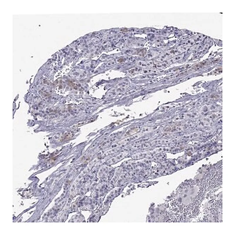 Merck Anti-MYO15A antibody produced in rabbit