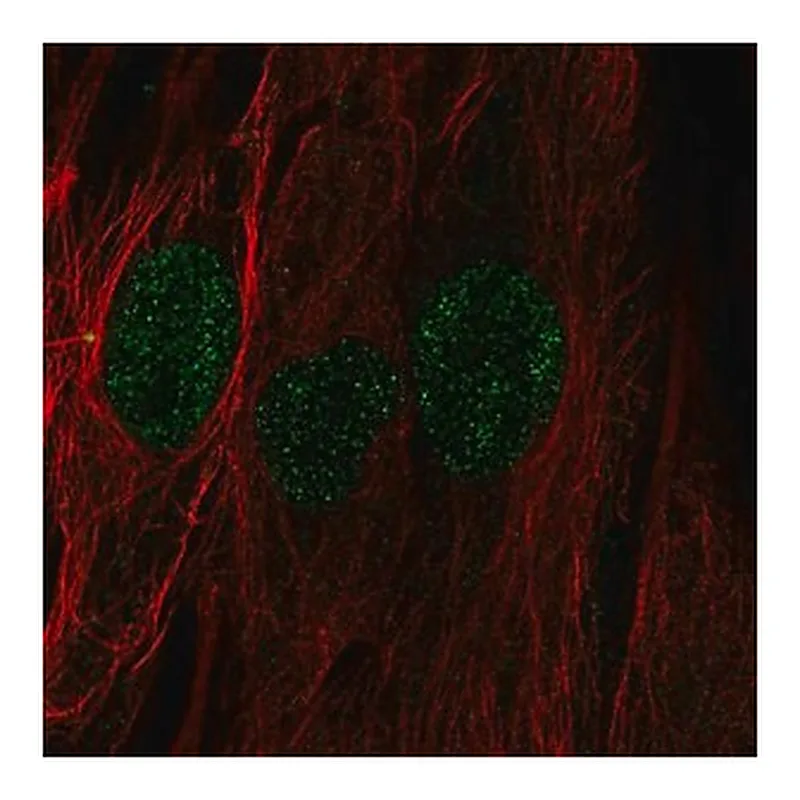 Merck Anti-C22orf23 antibody produced in rabbit