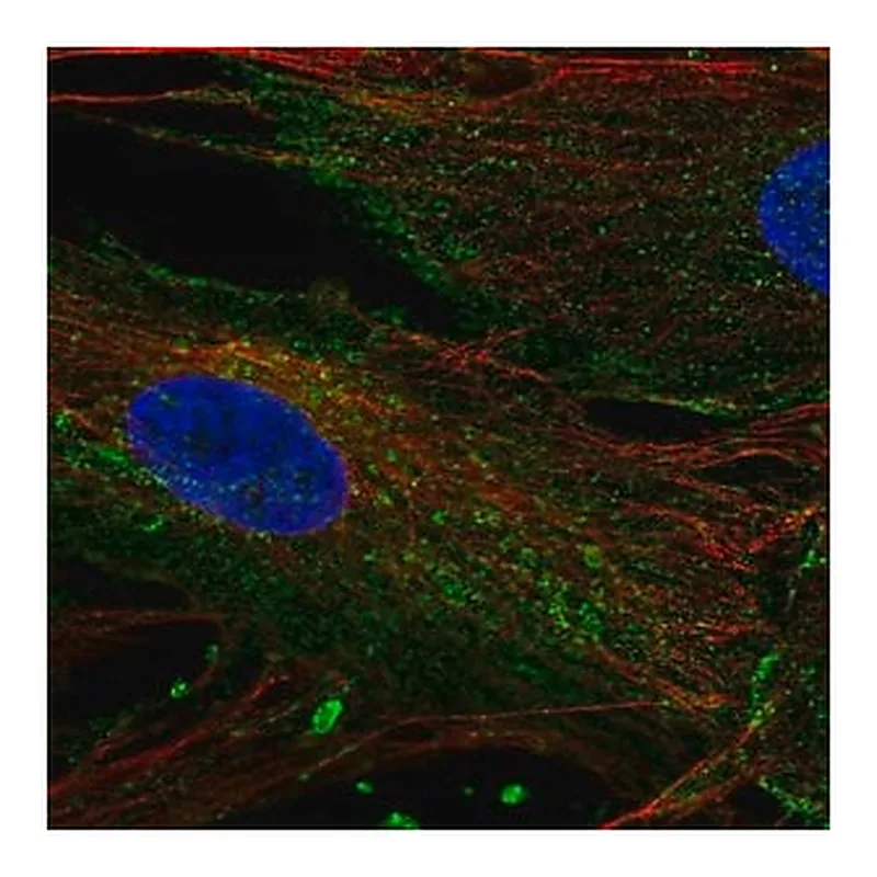 Merck Anti-CHIC2 antibody produced in rabbit