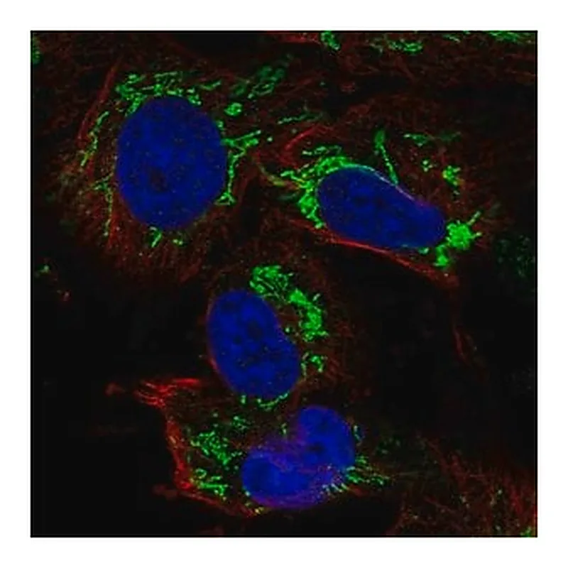 Merck Anti-TFB2M antibody produced in rabbit