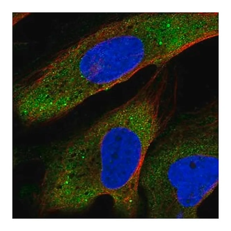 Merck Anti-YTHDF2 antibody produced in rabbit