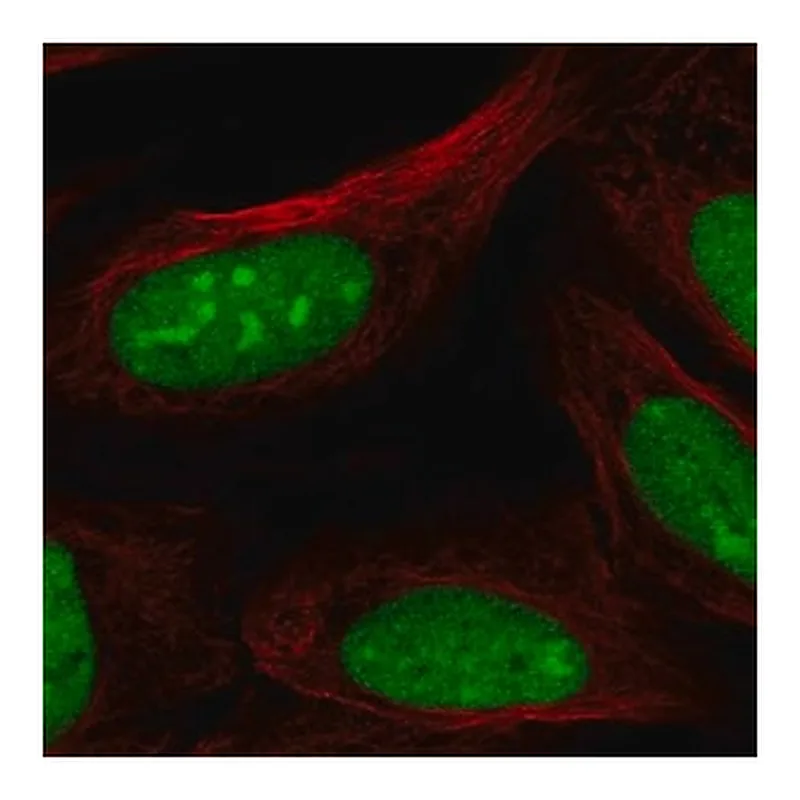 Merck Anti-CRISPLD2 antibody produced in rabbit