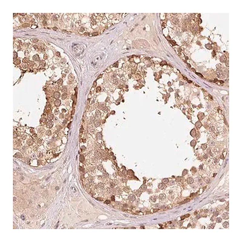 Merck Anti-PARK2 antibody produced in rabbit