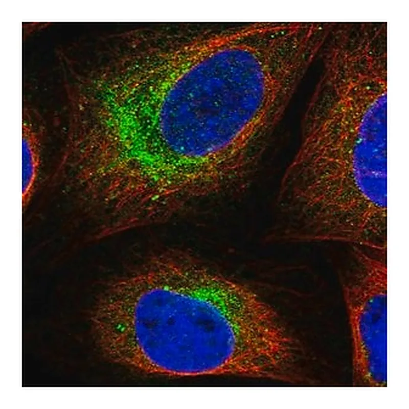 Merck Anti-SCN3B antibody produced in rabbit