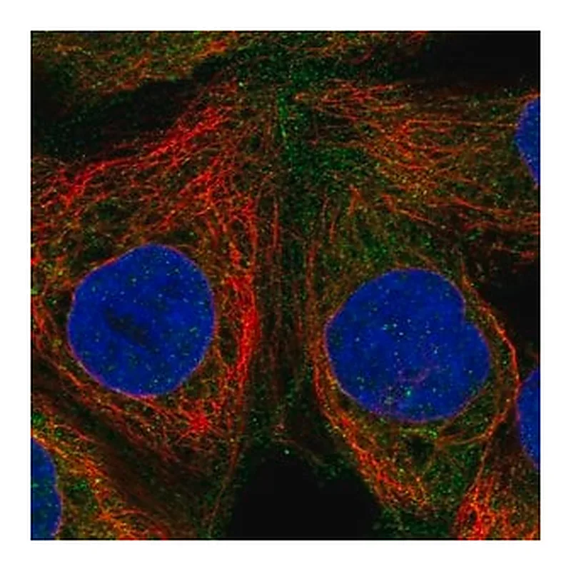 Merck Anti-RASGRP1 antibody produced in rabbit