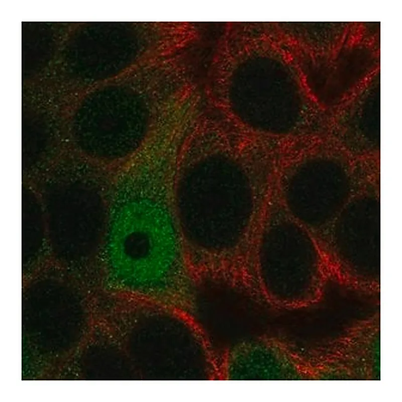 Merck Anti-AP5S1 antibody produced in rabbit