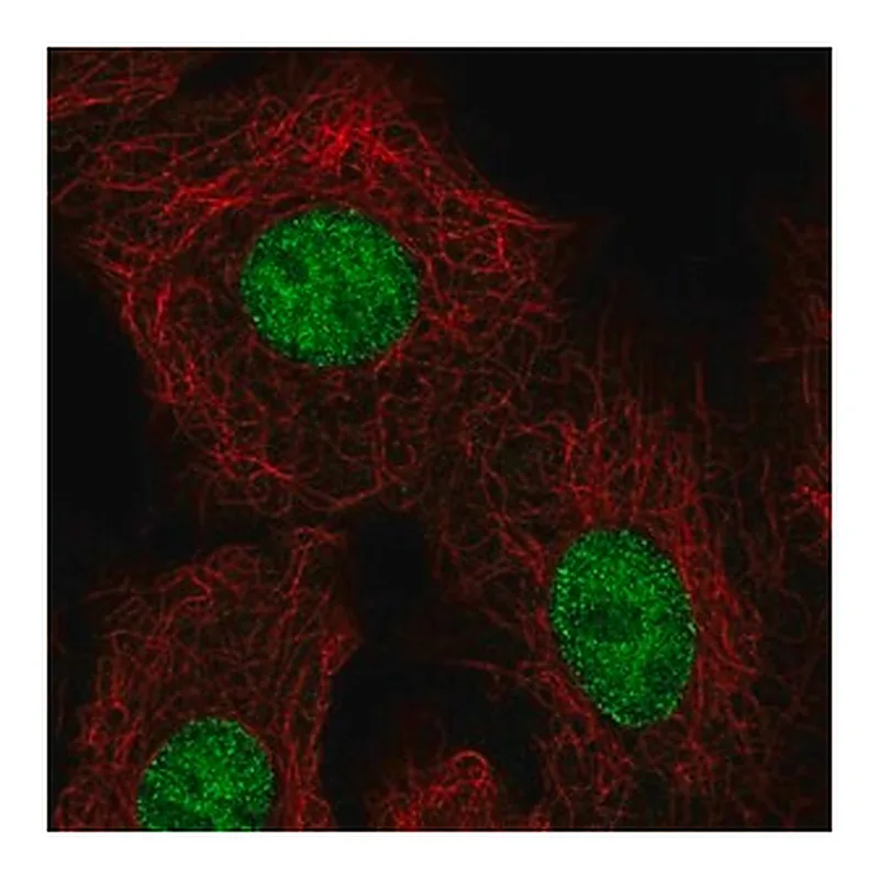 Merck Anti-HOXB5 antibody produced in rabbit
