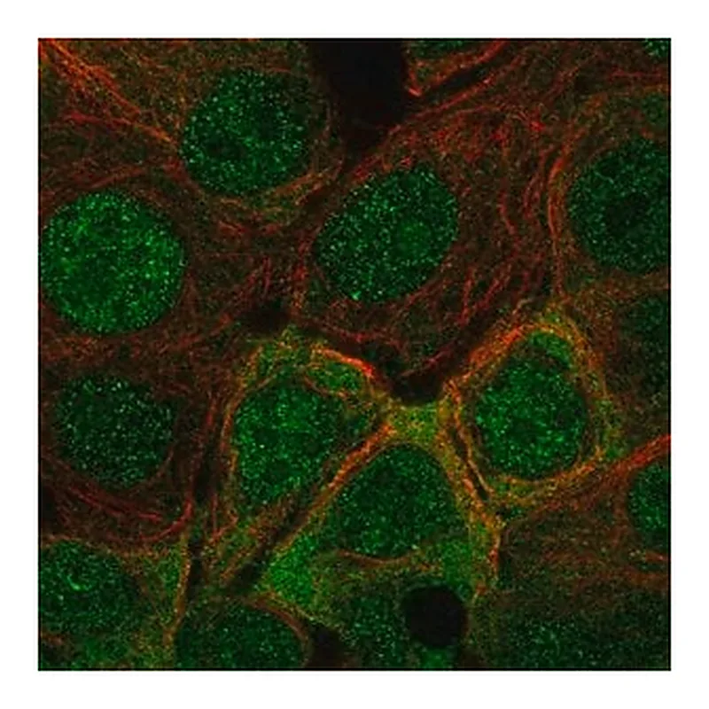 Merck Anti-IRS1 antibody produced in rabbit