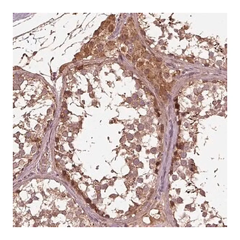 Merck Anti-METTL4 antibody produced in rabbit