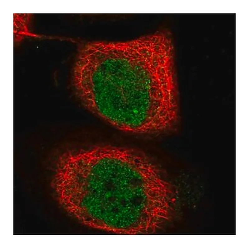 Merck Anti-TICRR antibody produced in rabbit