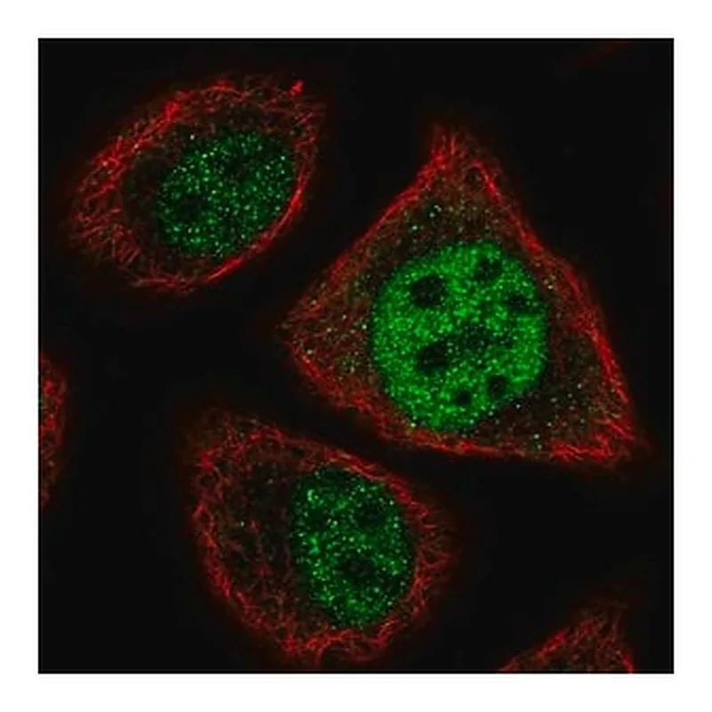 Merck Anti-ETV7 antibody produced in rabbit