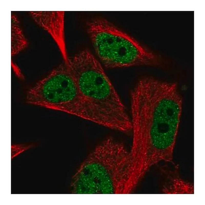 Merck Anti-PGAM2 antibody produced in rabbit