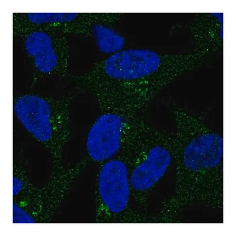 Merck Anti-DKK2 antibody produced in rabbit