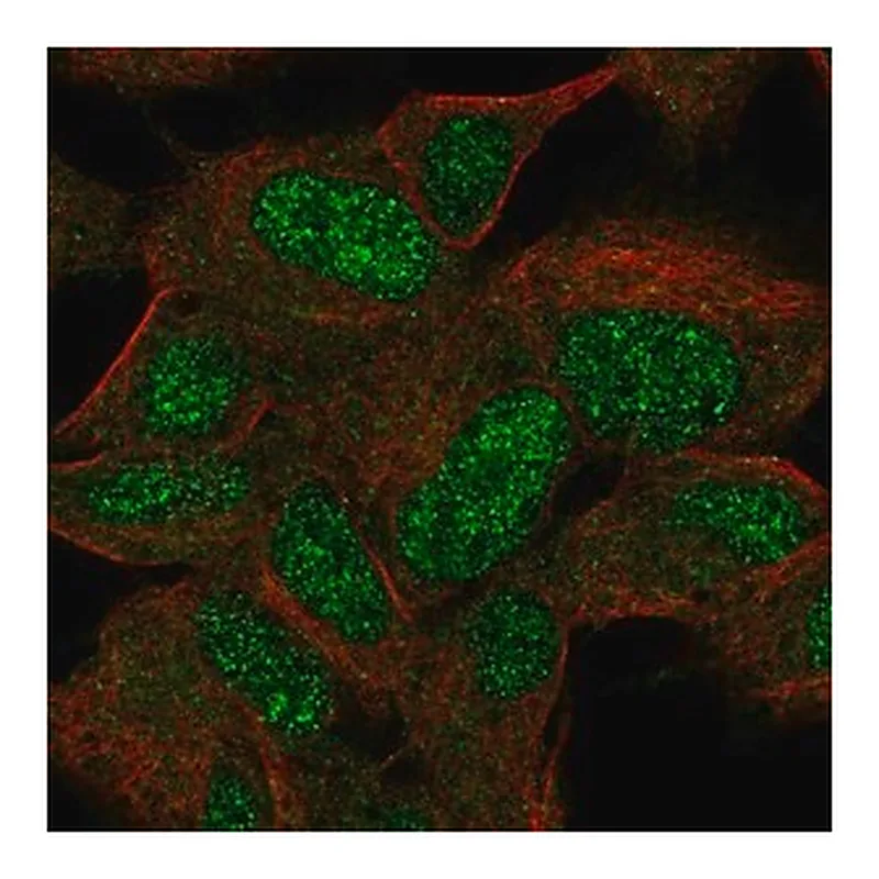 Merck Anti-KIAA0408 antibody produced in rabbit