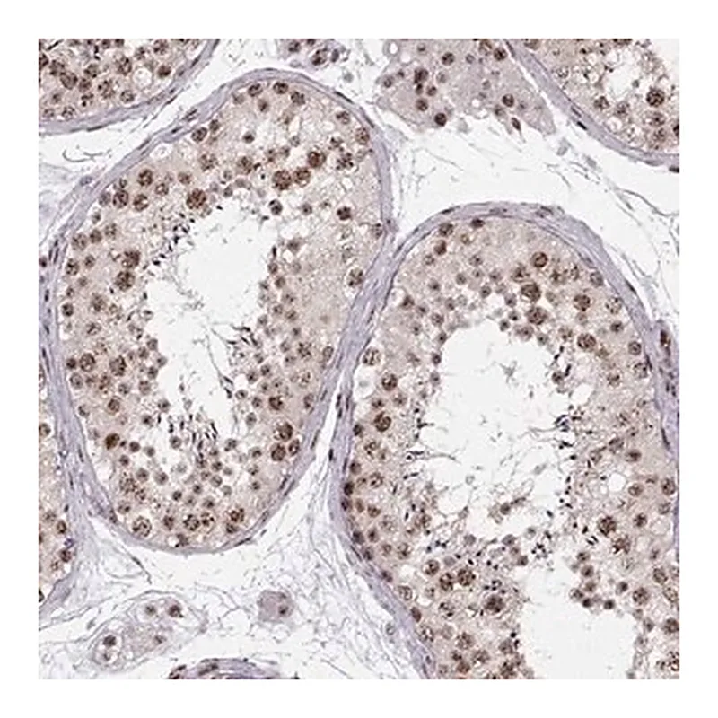Merck Anti-ZCCHC17 antibody produced in rabbit