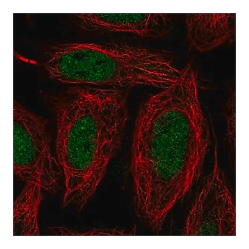 Merck Anti-SNAI1 antibody produced in rabbit