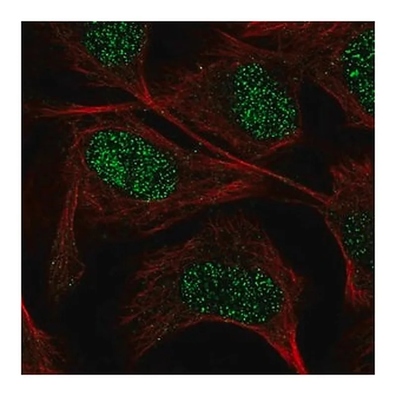 Merck Anti-GUCY1A3 antibody produced in rabbit