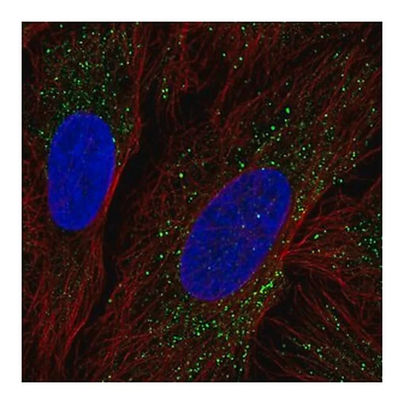 Merck Anti-ZDHHC17 antibody produced in rabbit