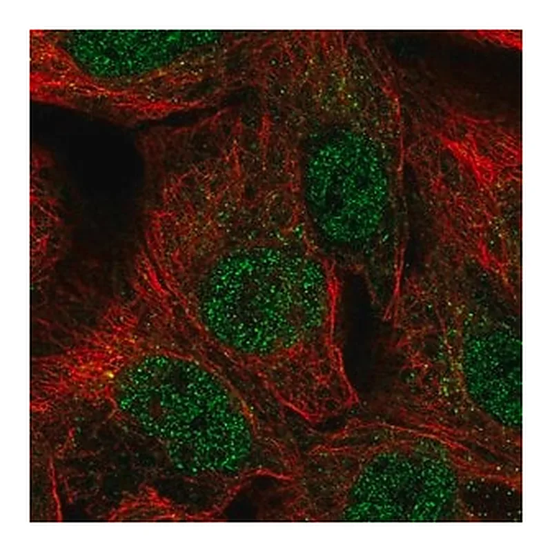 Merck Anti-NR2F2 antibody produced in rabbit