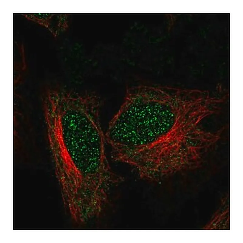 Merck Anti-ZNF594 antibody produced in rabbit