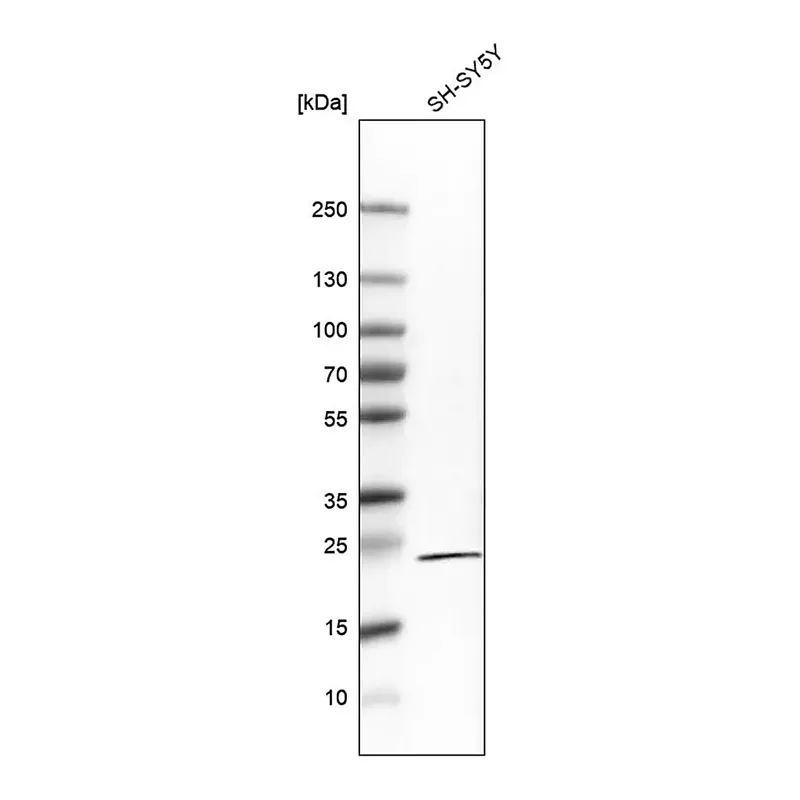 Merck Monoclonal Anti-RGS5 antibody produced in mouse