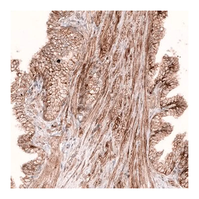 Merck Monoclonal Anti-ROR2 antibody produced in mouse