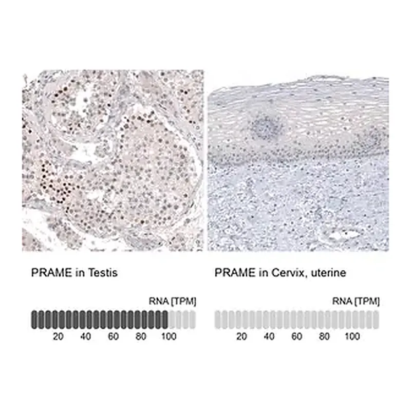 Merck Monoclonal Anti-PRAME antibody produced in mouse