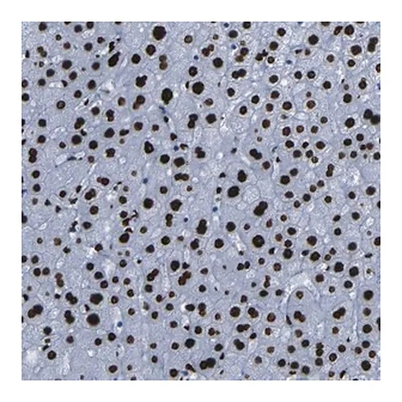 Merck Anti-NPIPB15