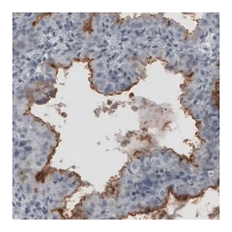 Merck Monoclonal Anti-MUC16 antibody produced in mouse