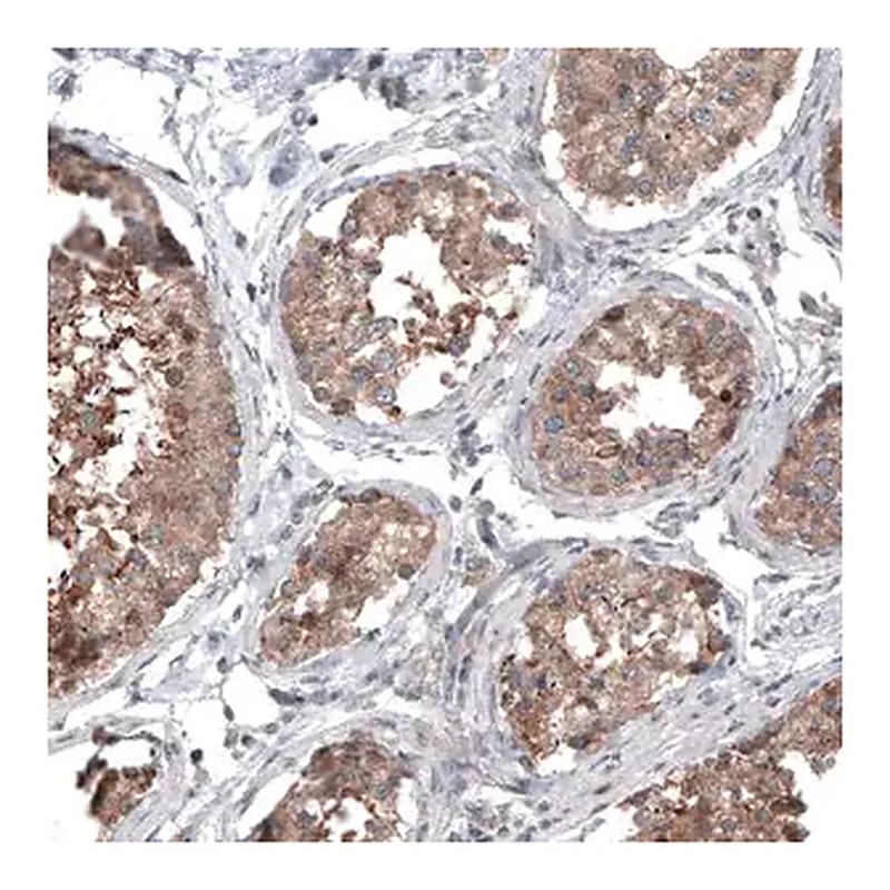 Merck Monoclonal Anti-BRAF antibody produced in mouse