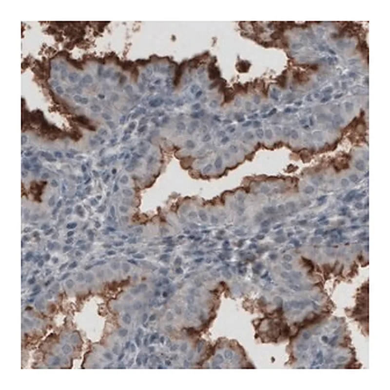 Merck Monoclonal Anti-MUC16 antibody produced in mouse