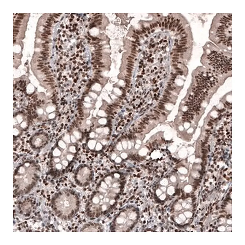 Merck Monoclonal Anti-SMCHD1 antibody produced in mouse