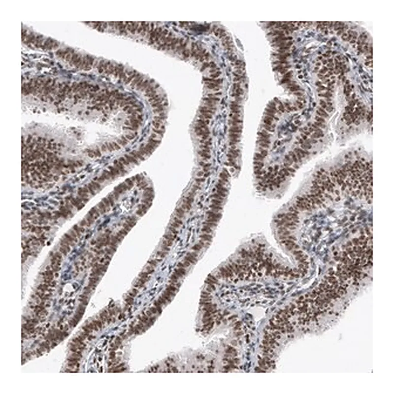 Merck Monoclonal Anti-SMCHD1 antibody produced in mouse