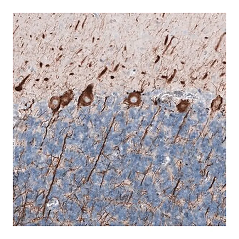 Merck Monoclonal Anti-NEFL antibody produced in mouse
