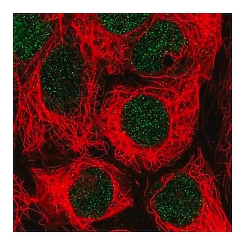 Merck Anti-SLC17A9 antibody produced in rabbit