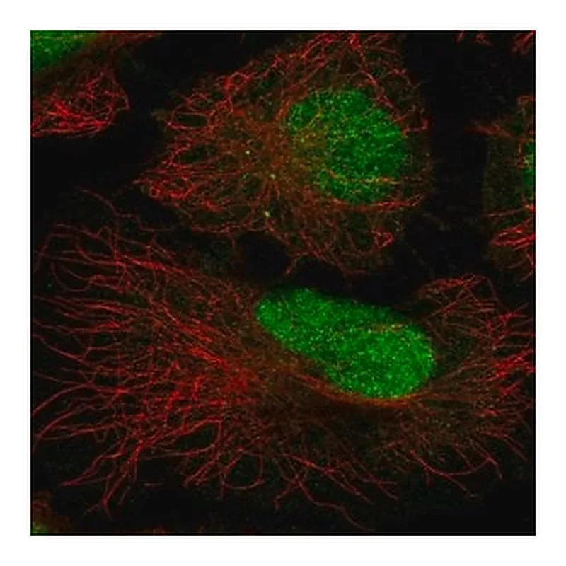 Merck Anti-ATRIP antibody produced in rabbit