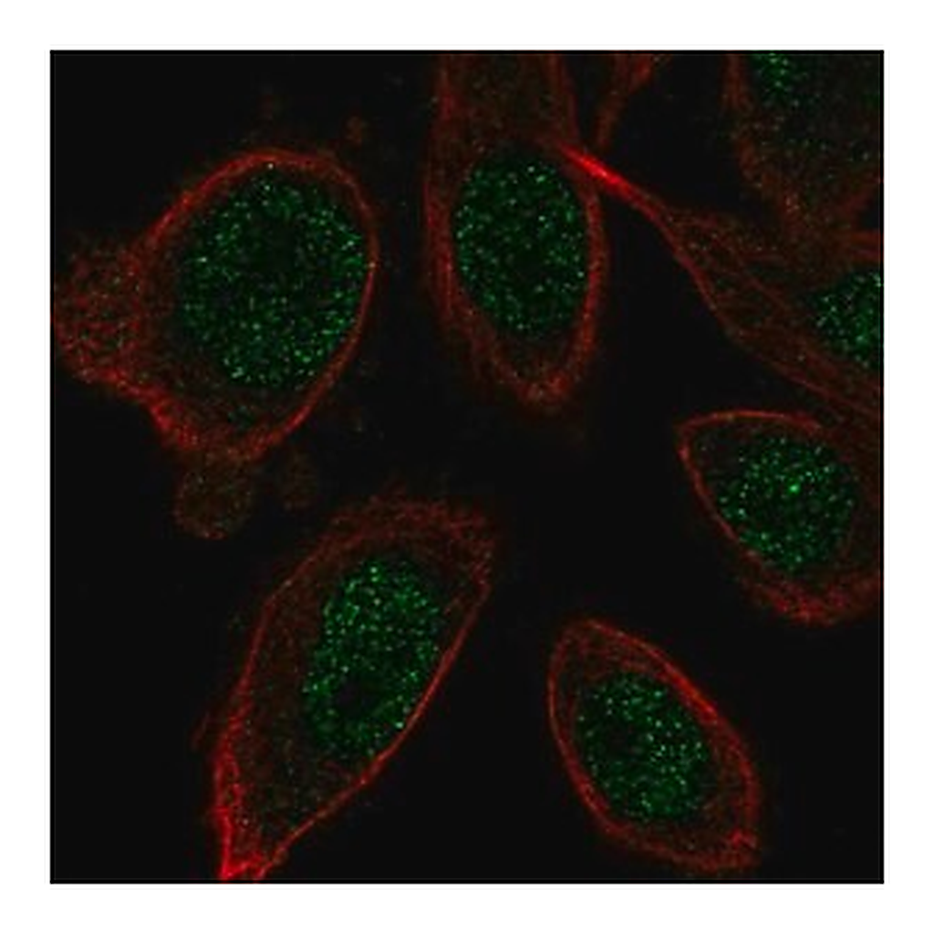Merck Anti-ZNF664 antibody produced in rabbit